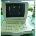 Volldigitaler Laptop-Ultraschallscanner